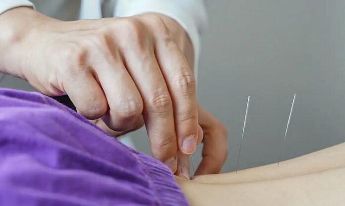 acupuntura koreanmedicine pixabay