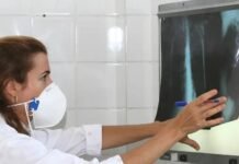 Pernambuco mantém alta de casos de tuberculose em 2025, com mais de 6 mil notificações