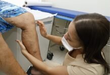 Petrolina: Prefeitura oferece tratamento de varizes para moradores de Rajada e Izacolândia