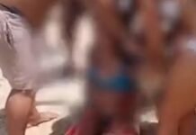 Justiça nega indenização para vítima de mordida de tubarão em Jaboatão dos Guararapes (PE)
