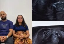 À espera do segundo filho, Érica precisa de ajuda para cirurgia intrauterina; bebê já está com malformação