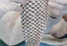 Brasil terá primeira fábrica do mundo de pele de tilápia para tratar queimaduras