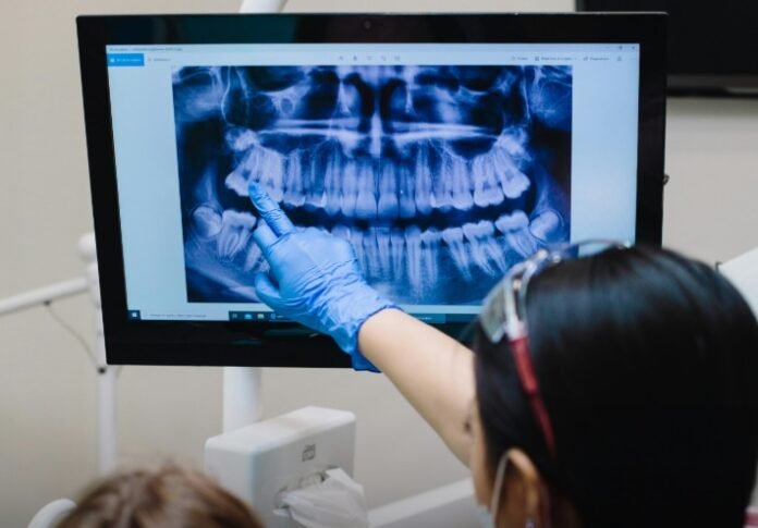 radiografiasdentes