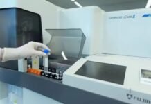 Exame de sangue que detecta Alzheimer chega ao Brasil