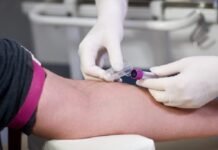 Jejum antes do exame de sangue pode não fazer diferença, sugere estudo